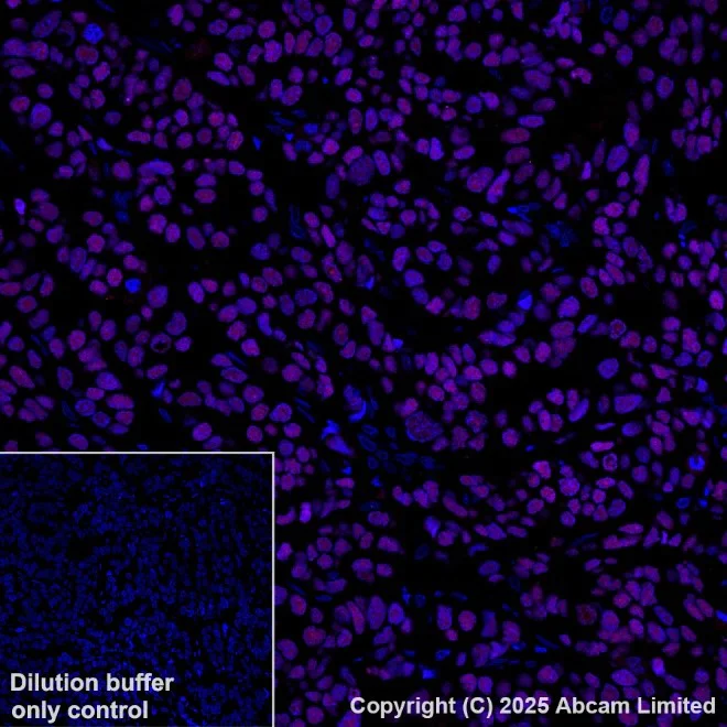 Immunohistochemistry (Formalin/PFA-fixed paraffin-embedded sections) - Antigen Retrieval Buffer (100X Tris-EDTA Buffer, pH 9.0) (AB93684)
