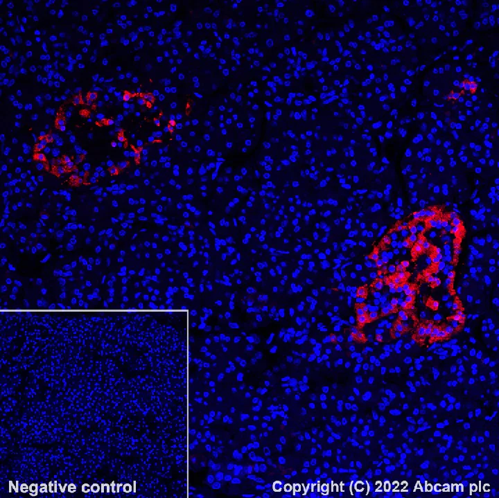 Immunohistochemistry (Formalin/PFA-fixed paraffin-embedded sections) - Antigen Retrieval Buffer (100X Tris-EDTA Buffer, pH 9.0) (AB93684)