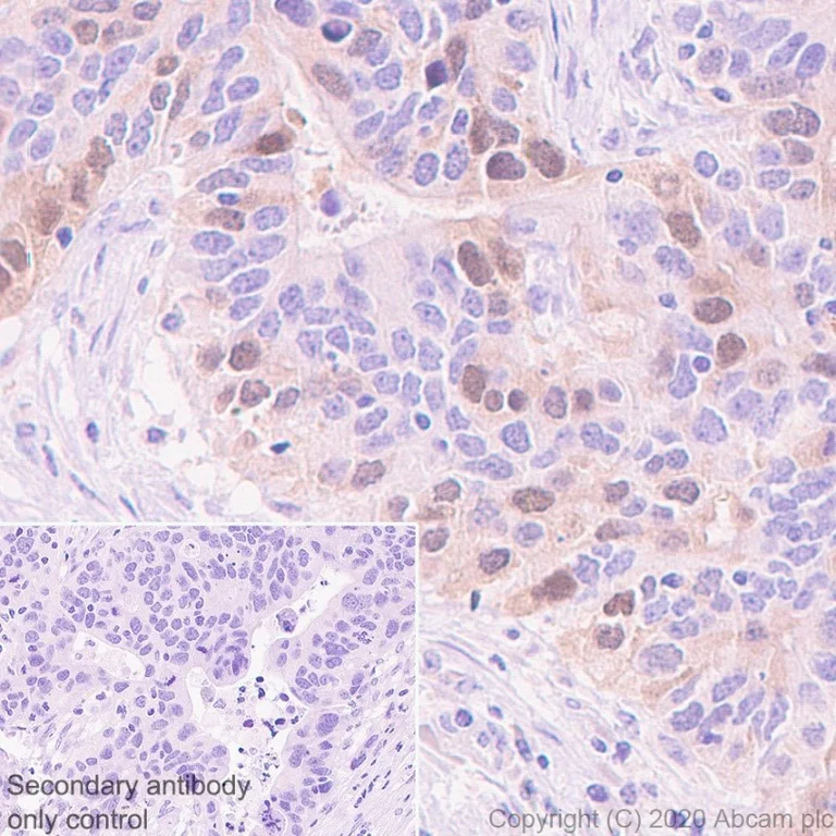Immunohistochemistry (Formalin/PFA-fixed paraffin-embedded sections) - Antigen Retrieval Buffer (100X Tris-EDTA Buffer, pH 9.0) (AB93684)