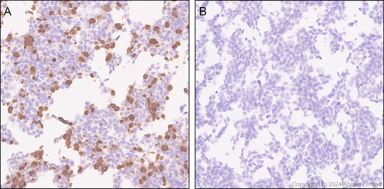 Immunohistochemistry (Formalin/PFA-fixed paraffin-embedded sections) - Anti‑Poly PR Antibody [PERA534G] (AB323367)