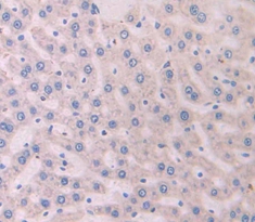 Immunohistochemistry (Formalin/PFA-fixed paraffin-embedded sections) - Anti-Antithrombin III/ATIII antibody (AB230981), expandable thumbnail