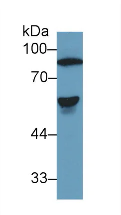 Western blot - Anti-Antithrombin III/ATIII antibody (AB230981)