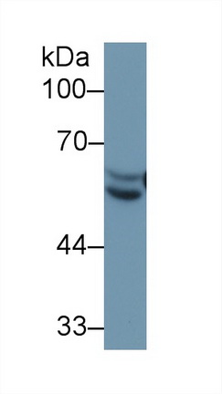 Western blot - Anti-Antithrombin III/ATIII antibody (AB230981), expandable thumbnail