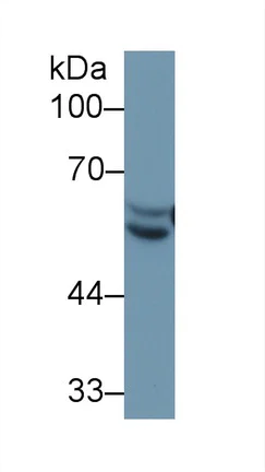 Western blot - Anti-Antithrombin III/ATIII antibody (AB230981)
