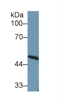 Western blot - Anti-Antithrombin III/ATIII antibody (AB230981)