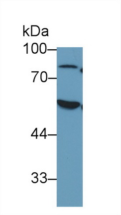 Western blot - Anti-Antithrombin III/ATIII antibody (AB230981), expandable thumbnail