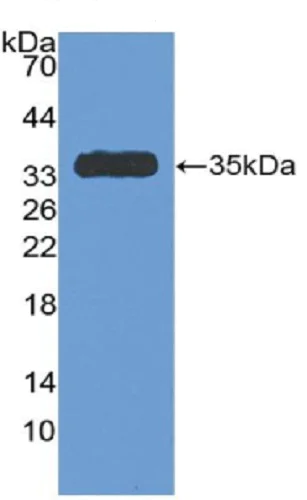 Western blot - Anti-Antithrombin III/ATIII antibody (AB230981)