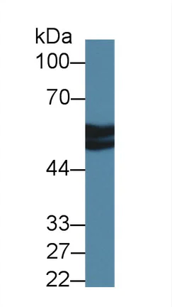 Western blot - Anti-Antithrombin III/ATIII antibody (AB231525)
