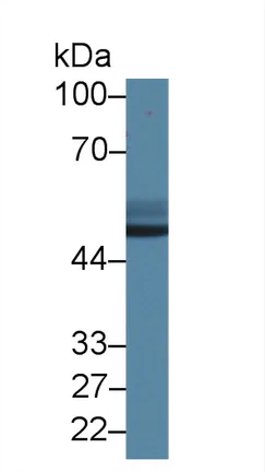 Western blot - Anti-Antithrombin III/ATIII antibody (AB231525)