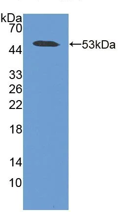 Western blot - Anti-Antithrombin III/ATIII antibody (AB231525)