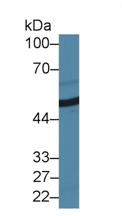 Western blot - Anti-Antithrombin III/ATIII antibody (AB231525)