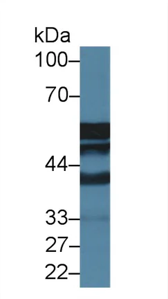 Western blot - Anti-Antithrombin III/ATIII antibody (AB231525)