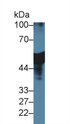 Western blot - Anti-Antithrombin III/ATIII antibody (AB231525)