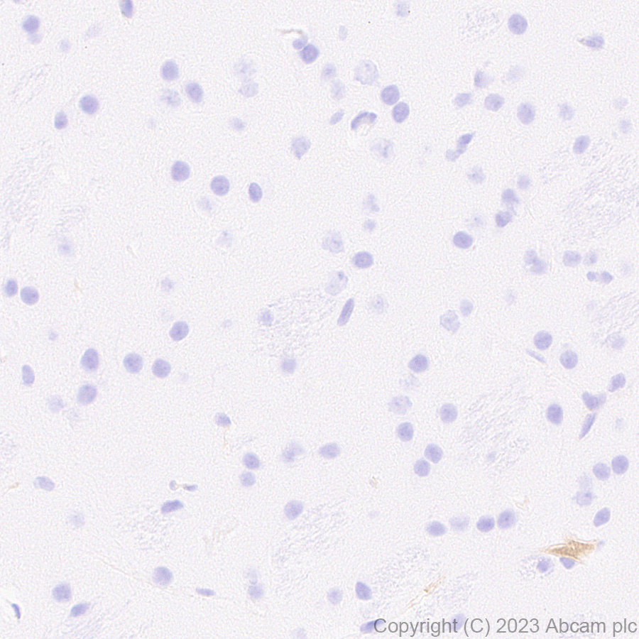 Immunohistochemistry (Formalin/PFA-fixed paraffin-embedded sections) - Anti-Antithrombin III/ATIII antibody [EPR28171-25] (AB314549), expandable thumbnail