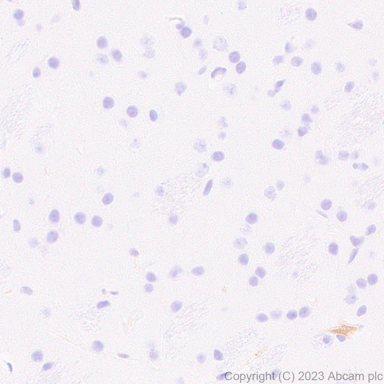 Immunohistochemistry (Formalin/PFA-fixed paraffin-embedded sections) - Anti-Antithrombin III/ATIII antibody [EPR28171-25] (AB314549)