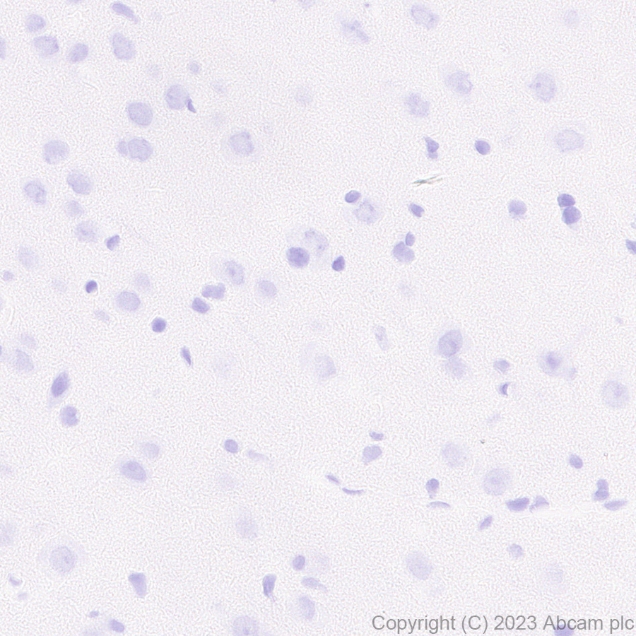 Immunohistochemistry (Formalin/PFA-fixed paraffin-embedded sections) - Anti-Antithrombin III/ATIII antibody [EPR28171-25] (AB314549), expandable thumbnail