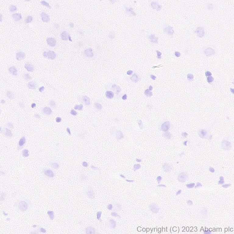 Immunohistochemistry (Formalin/PFA-fixed paraffin-embedded sections) - Anti-Antithrombin III/ATIII antibody [EPR28171-25] (AB314549)
