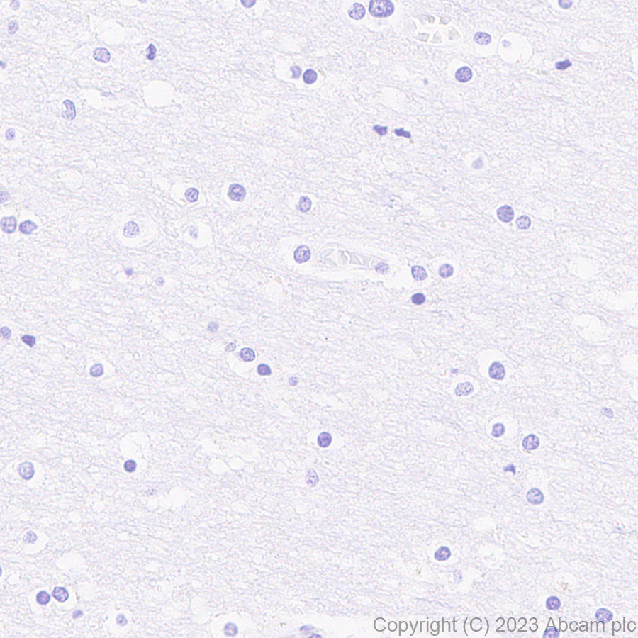 Immunohistochemistry (Formalin/PFA-fixed paraffin-embedded sections) - Anti-Antithrombin III/ATIII antibody [EPR28171-25] (AB314549), expandable thumbnail