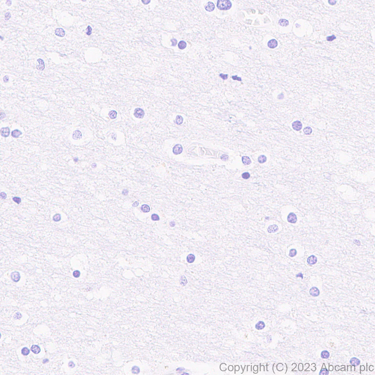 Immunohistochemistry (Formalin/PFA-fixed paraffin-embedded sections) - Anti-Antithrombin III/ATIII antibody [EPR28171-25] - BSA and Azide free (AB314550)