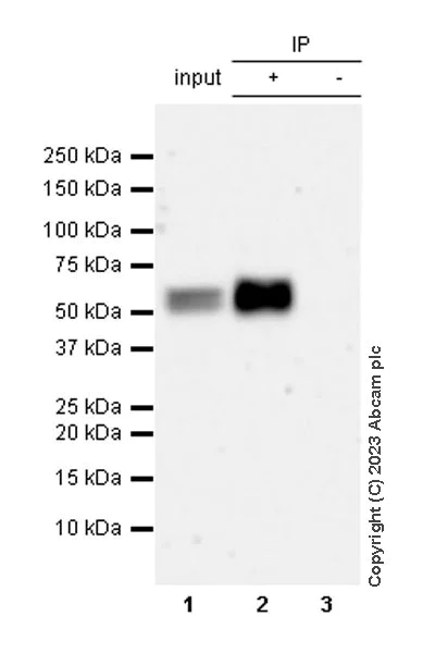 Immunoprecipitation - Anti-Antithrombin III/ATIII antibody [EPR28171-25] - BSA and Azide free (AB314550)