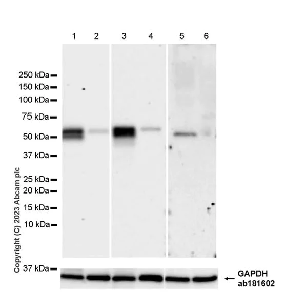 Western blot - Anti-Antithrombin III/ATIII antibody [EPR28171-25] - BSA and Azide free (AB314550)