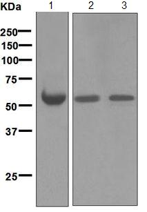 Western blot - Anti-Antithrombin III/ATIII antibody [EPR5371] (AB124808)
