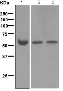 Western blot - Anti-Antithrombin III/ATIII antibody [EPR5371] (AB124808)