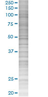 Antithrombin III overexpression 293T lysate (whole cell)