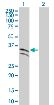 Western blot - Antithrombin III overexpression 293T lysate (whole cell) (AB94043)