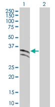Western blot - Antithrombin III overexpression 293T lysate (whole cell) (AB94043)