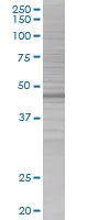 SDS-PAGE - ANXA7 overexpression 293T lysate (whole cell) (AB94175)