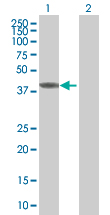 Western blot - ANXA7 overexpression 293T lysate (whole cell) (AB94175)