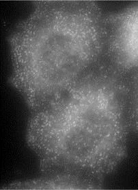 Immunocytochemistry/ Immunofluorescence - Anti-AP-2 complex subunit alpha-1 antibody (AB189995)