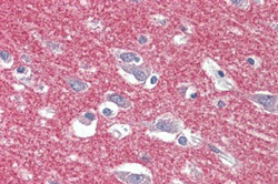 Immunohistochemistry (Formalin/PFA-fixed paraffin-embedded sections) - Anti-AP-2 complex subunit alpha-1 antibody (AB189995)