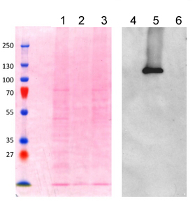 Western blot - Anti-AP-2 complex subunit alpha-1 antibody (AB189995)