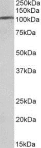 Western blot - Anti-AP-2 complex subunit alpha-1 antibody (AB189995)