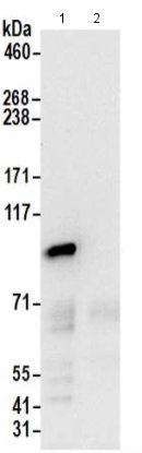 Immunoprecipitation - Anti-AP-2 complex subunit alpha-1 antibody (AB205222), expandable thumbnail