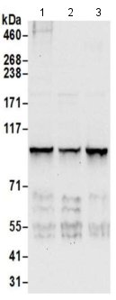 Western blot - Anti-AP-2 complex subunit alpha-1 antibody (AB205222), expandable thumbnail