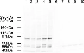 Western blot - Anti-AP-2 complex subunit alpha-1 antibody (AB3707)