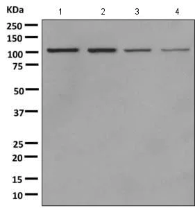 Western blot - Anti-AP-2 complex subunit alpha-1 antibody [EPR7573(2)(B)] (AB170955)