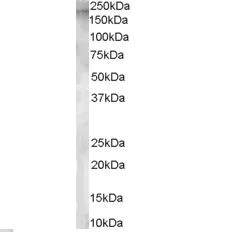 Western blot - Anti-AP-A antibody (AB36122)