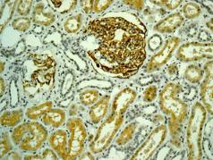 Immunohistochemistry (Formalin/PFA-fixed paraffin-embedded sections) - Anti-AP-A antibody [EPR9410] (AB139179)