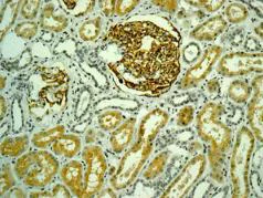 Immunohistochemistry (Formalin/PFA-fixed paraffin-embedded sections) - Anti-AP-A antibody [EPR9410] (AB139179)