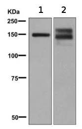 Western blot - Anti-AP-A antibody [EPR9410] - BSA and Azide free (AB248862)