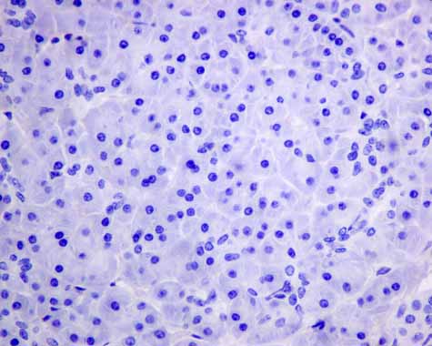 Immunohistochemistry (Formalin/PFA-fixed paraffin-embedded sections) - Anti-AP-A antibody [EPR9411(2)] (AB155991), expandable thumbnail