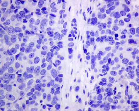 Immunohistochemistry (Formalin/PFA-fixed paraffin-embedded sections) - Anti-AP-A antibody [EPR9411(2)] (AB155991)