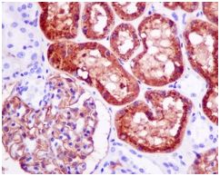 Immunohistochemistry (Formalin/PFA-fixed paraffin-embedded sections) - Anti-AP-A antibody [EPR9411(2)] (AB155991), expandable thumbnail