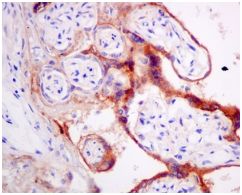 Immunohistochemistry (Formalin/PFA-fixed paraffin-embedded sections) - Anti-AP-A antibody [EPR9411(2)] (AB155991), expandable thumbnail