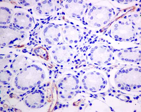 Immunohistochemistry (Formalin/PFA-fixed paraffin-embedded sections) - Anti-AP-A antibody [EPR9411(2)] (AB155991), expandable thumbnail
