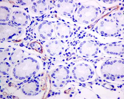 Immunohistochemistry (Formalin/PFA-fixed paraffin-embedded sections) - Anti-AP-A antibody [EPR9411(2)] (AB155991)
